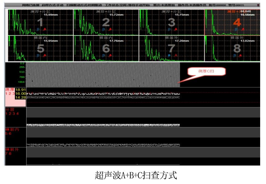 超声波扫查.jpg